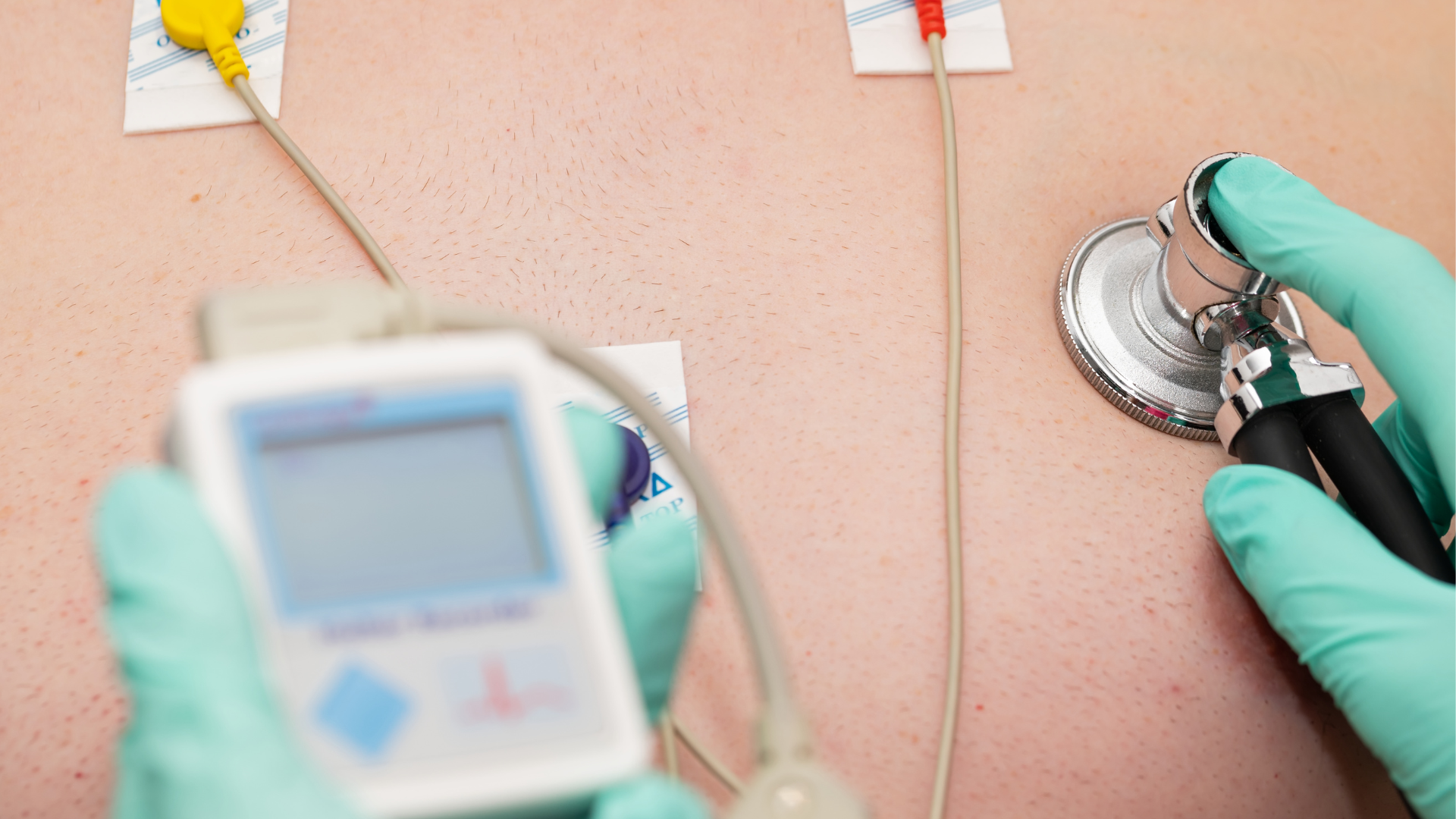 EKG Holter – wszystko, co musisz wiedzieć