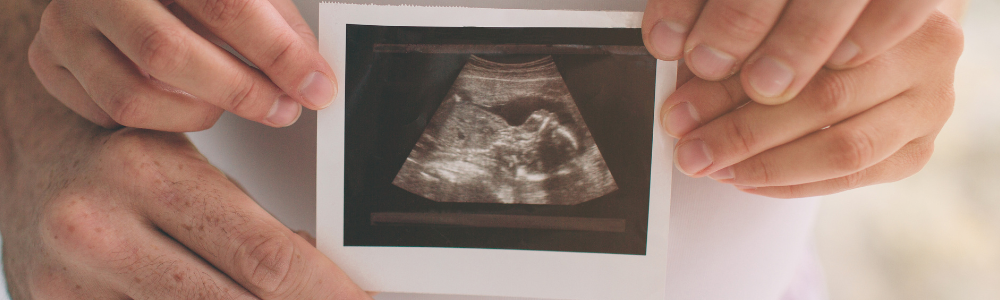 USG w ciąży - zdjęcie USG płodu