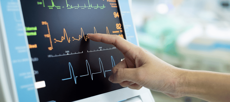 zawał serca a EKG